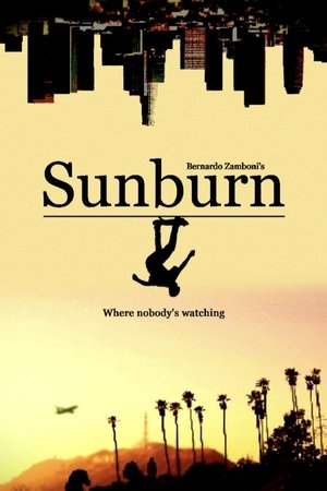 Sunburn