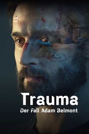 Trauma