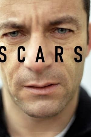 Scars