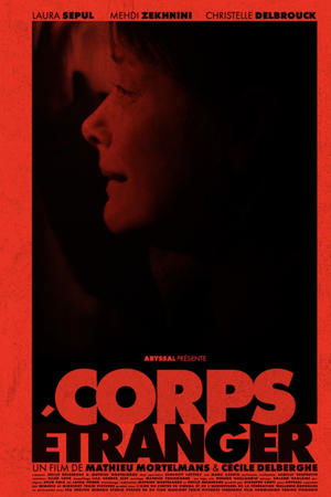 Corps étranger