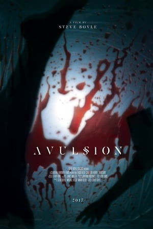 Avulsion
