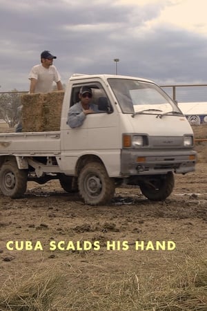Cuba Scalds His Hand
