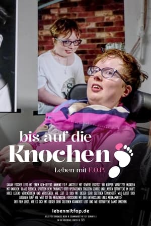 Bis auf die Knochen - Leben mit FOP