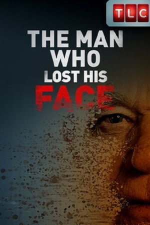 The Man Who Lost His Face