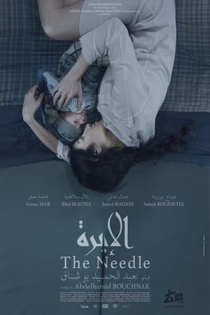 الإبرة
