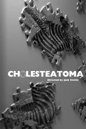 Cholesteatoma