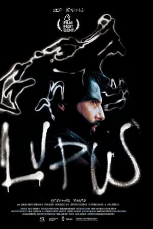 Lupus