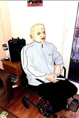 Anecdotes of a Baldmen