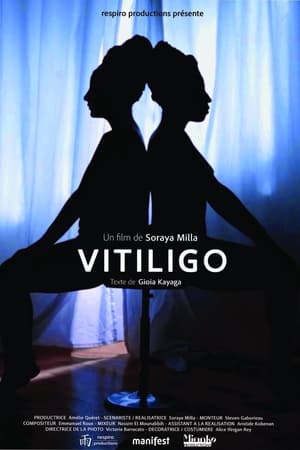 Vitiligo